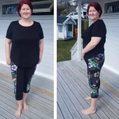 gallery-156-for-204095